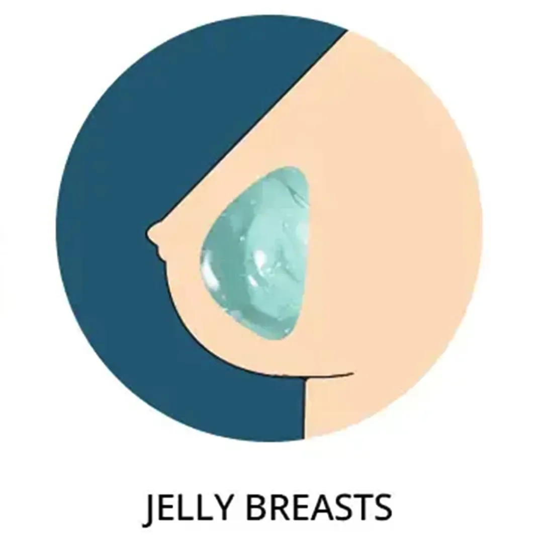 Jelly Breast: Ultra-Soft, Realistic Feel view 1